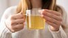 Can-Warm-Water-Drinks-Actually-Help-You-Lose-Weight?-Here-s-What-You-Need-To-Know...